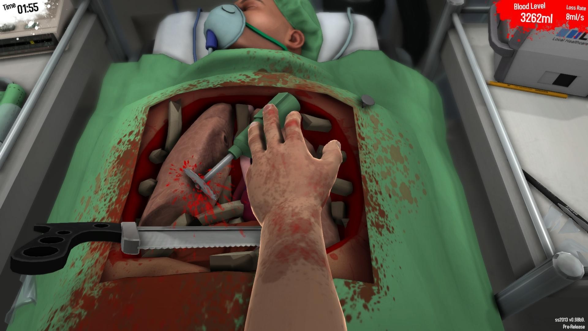 Surgeon Simulator — screenshot 1